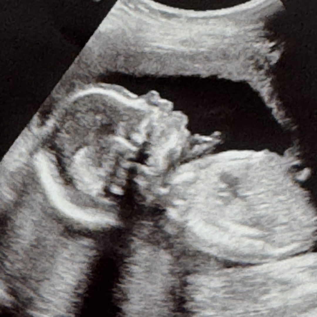 Photo shared by Alancia for their Babylist baby registry.