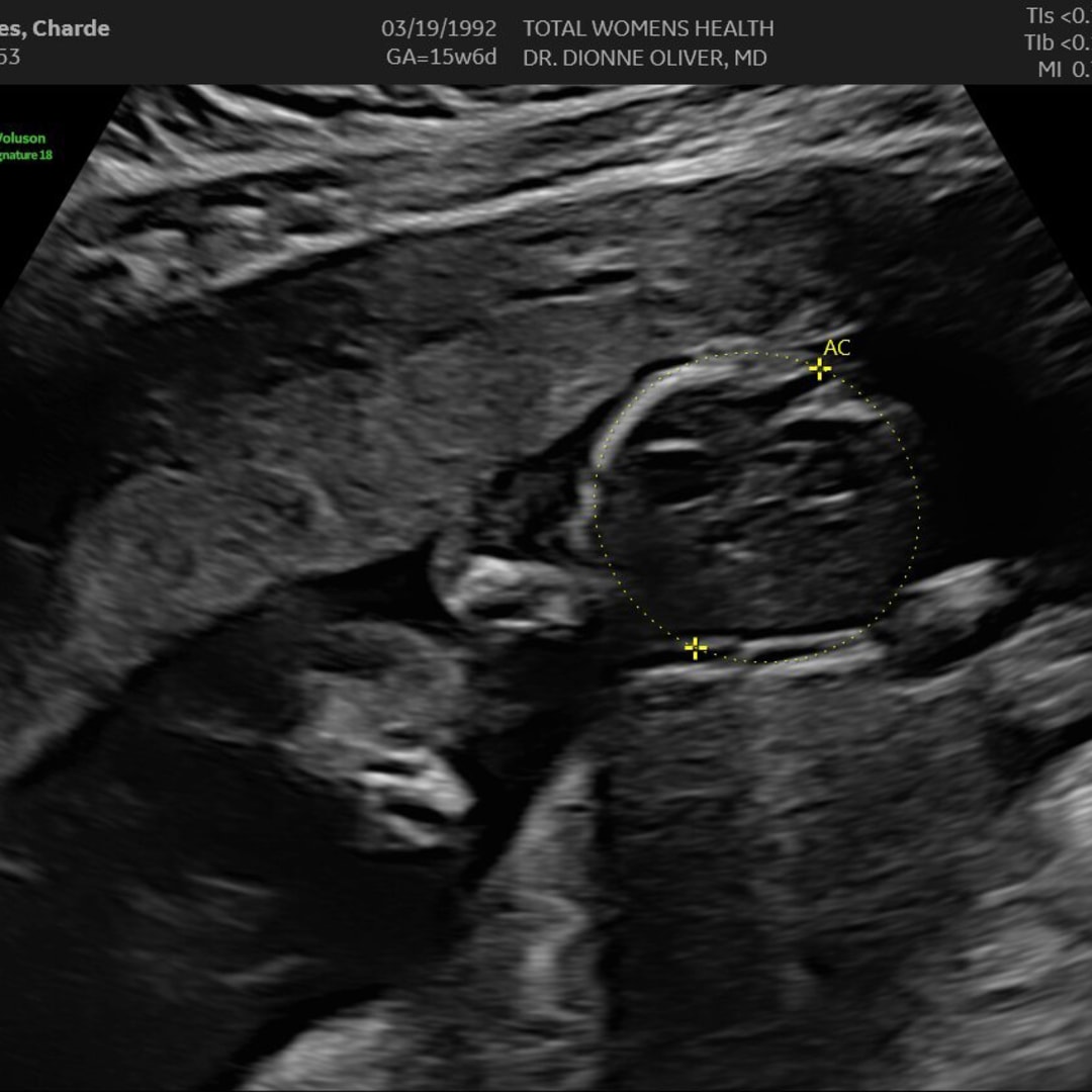 Photo shared by Charde for their Babylist baby registry.