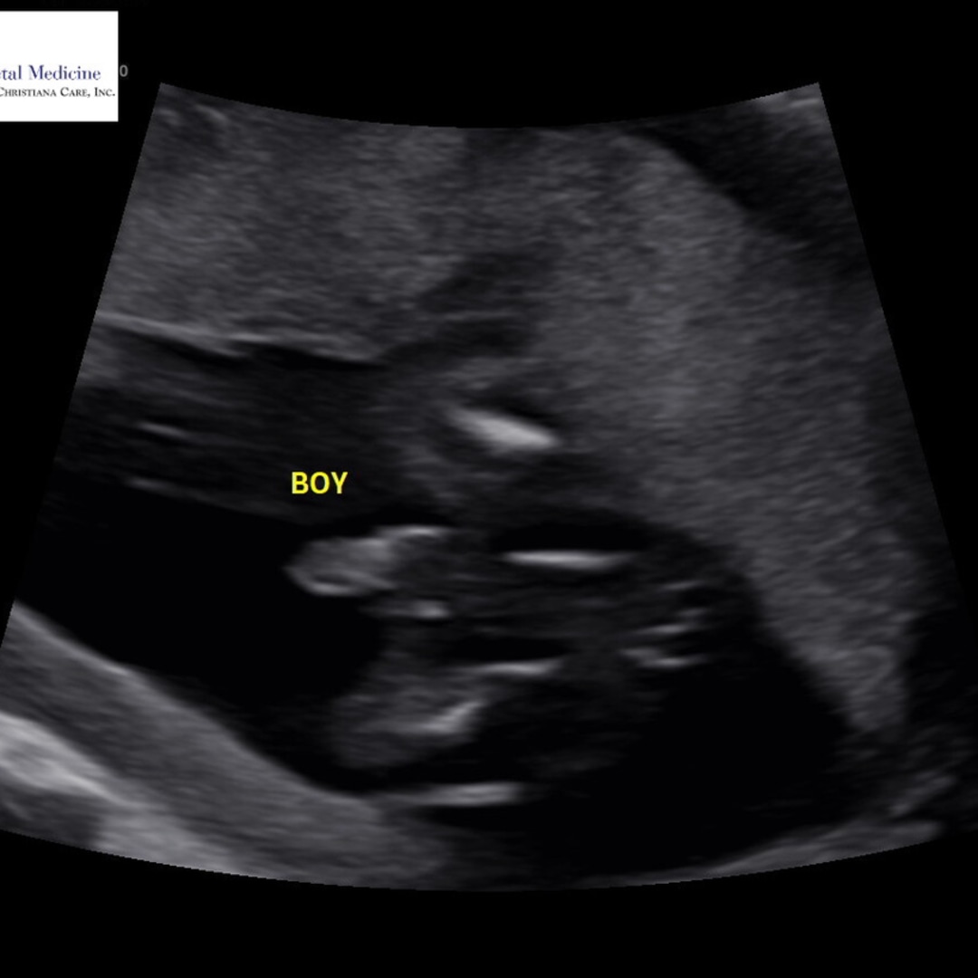 Photo shared by Ky for their Babylist baby registry.