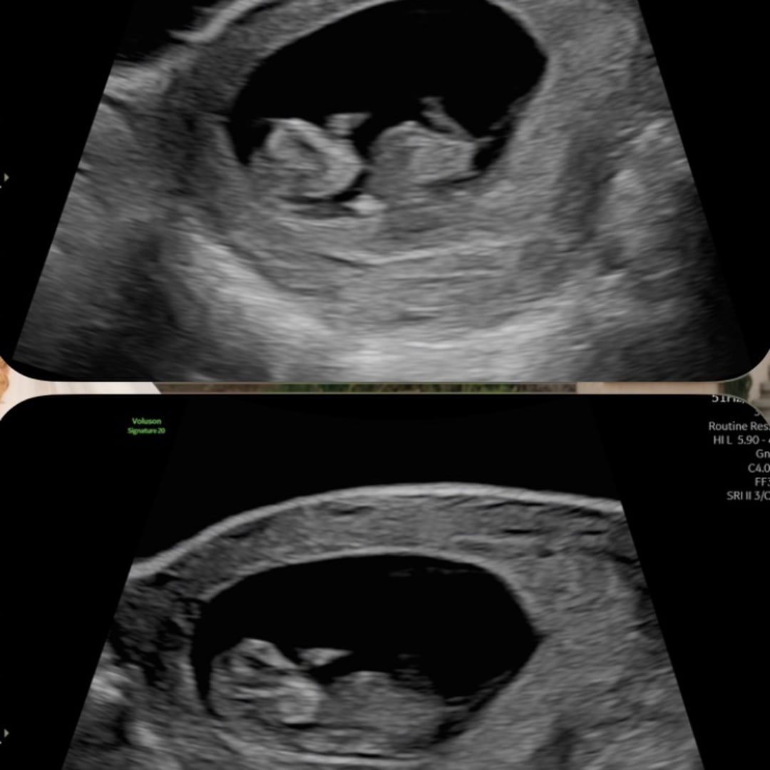Photo shared by Brigid for their Babylist baby registry.