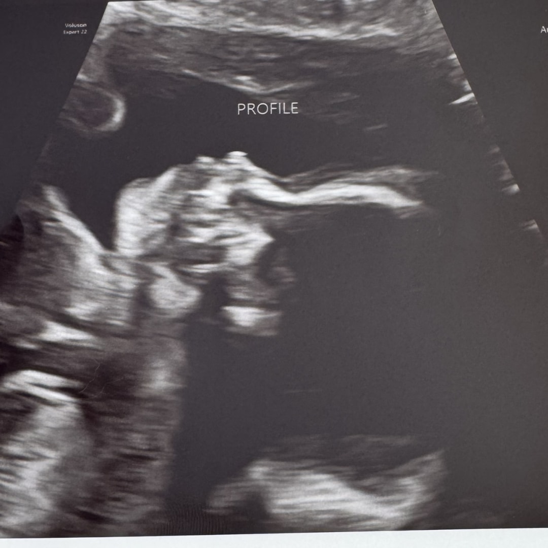 Photo shared by Miah for their Babylist baby registry.