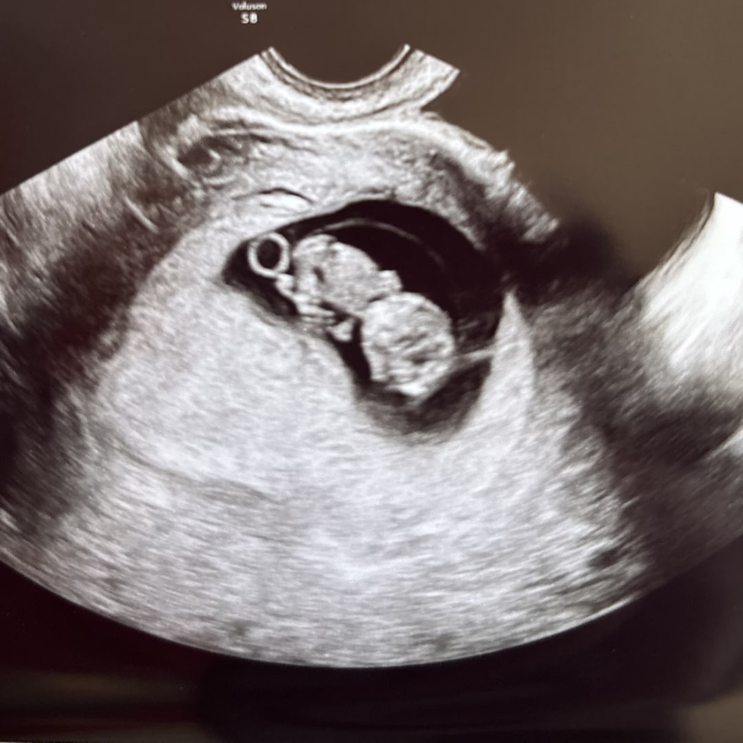 Photo shared by Denalyn for their Babylist baby registry.