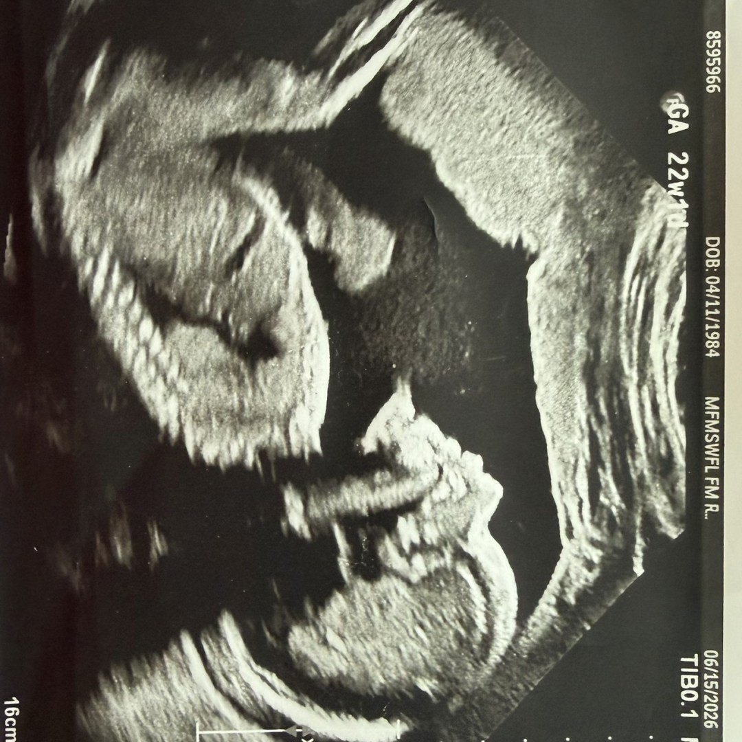 Photo shared by Azolea (Azzie) & Miguel for their Babylist baby registry.