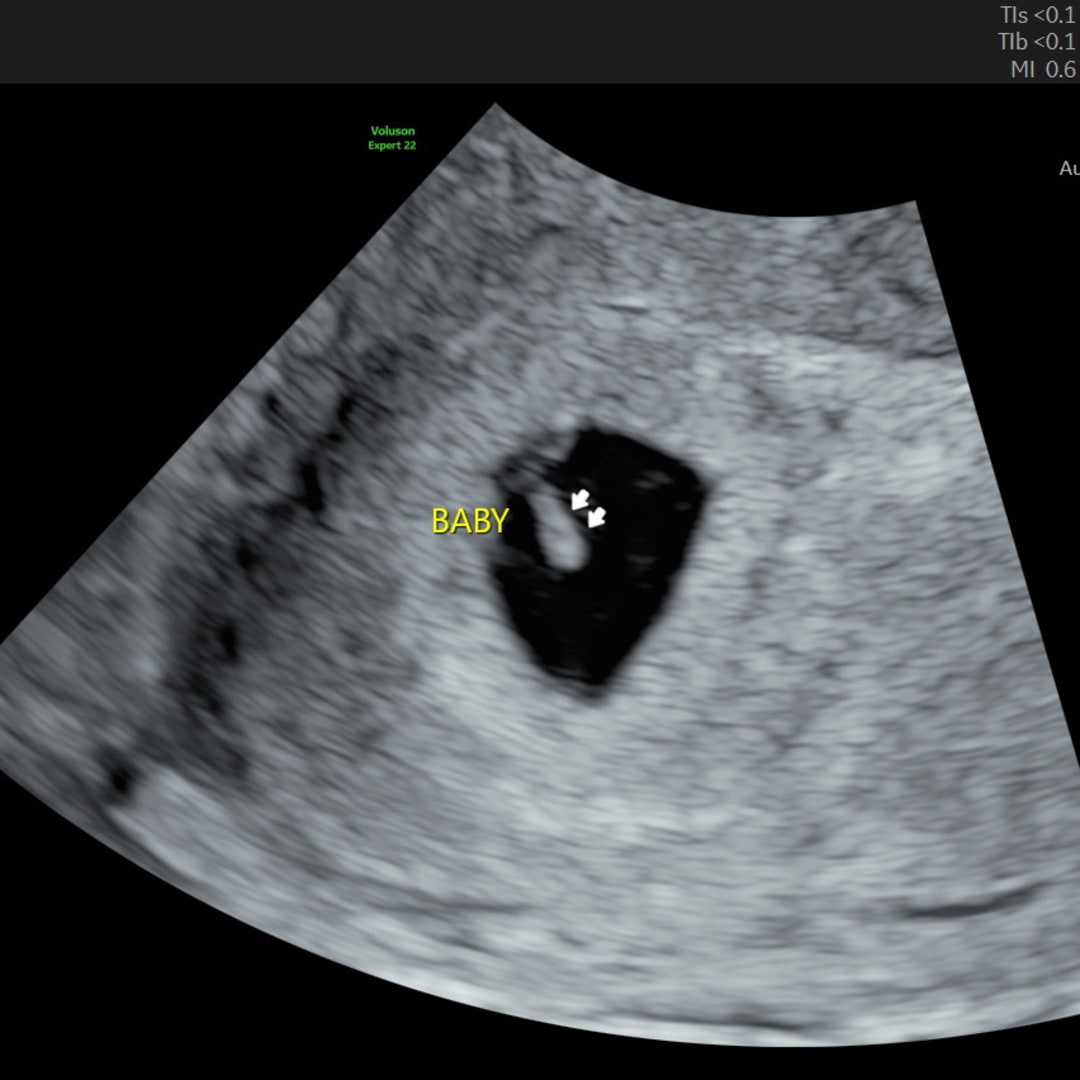 Photo shared by Gianna for their Babylist baby registry.