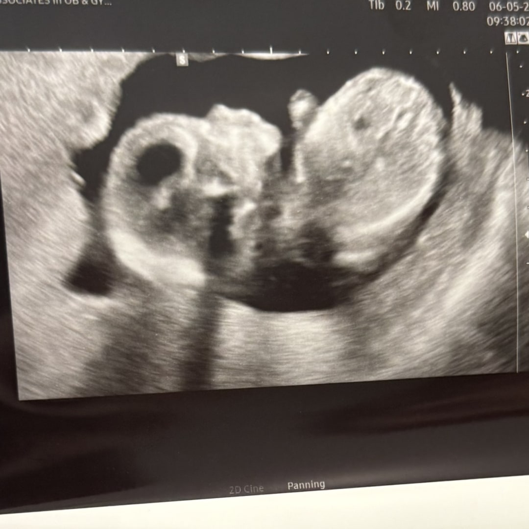 Photo shared by Estefany for their Babylist baby registry.