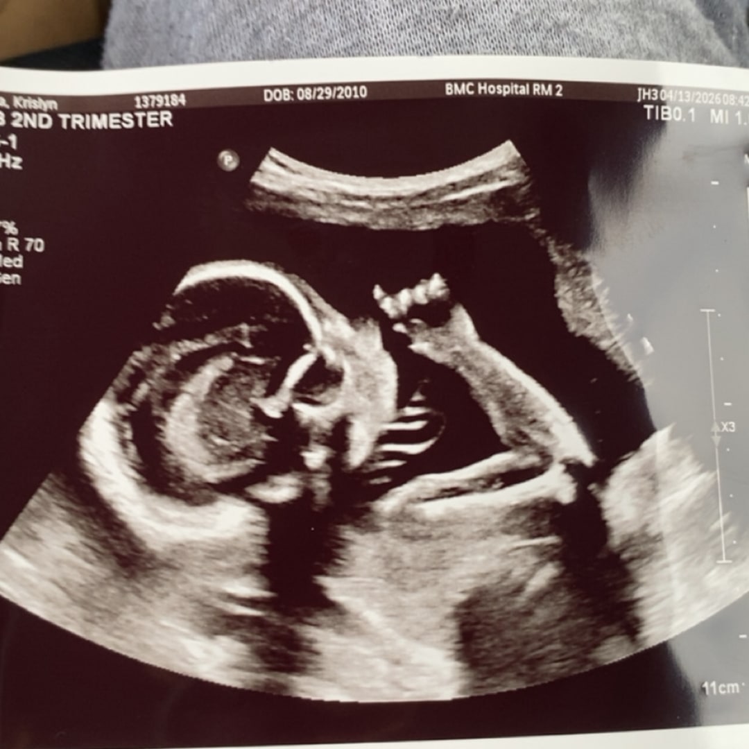 Photo shared by Krislyn for their Babylist baby registry.