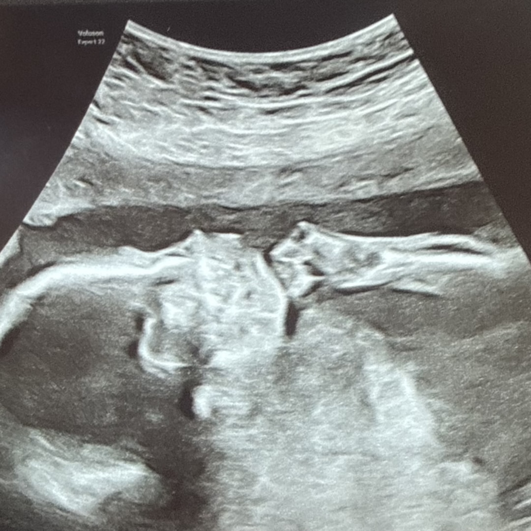 Photo shared by Karina for their Babylist baby registry.