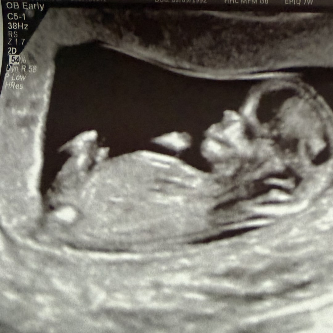 Photo shared by Briana for their Babylist baby registry.
