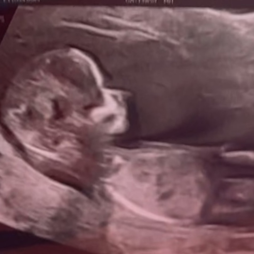 Photo shared by Franishka for their Babylist baby registry.