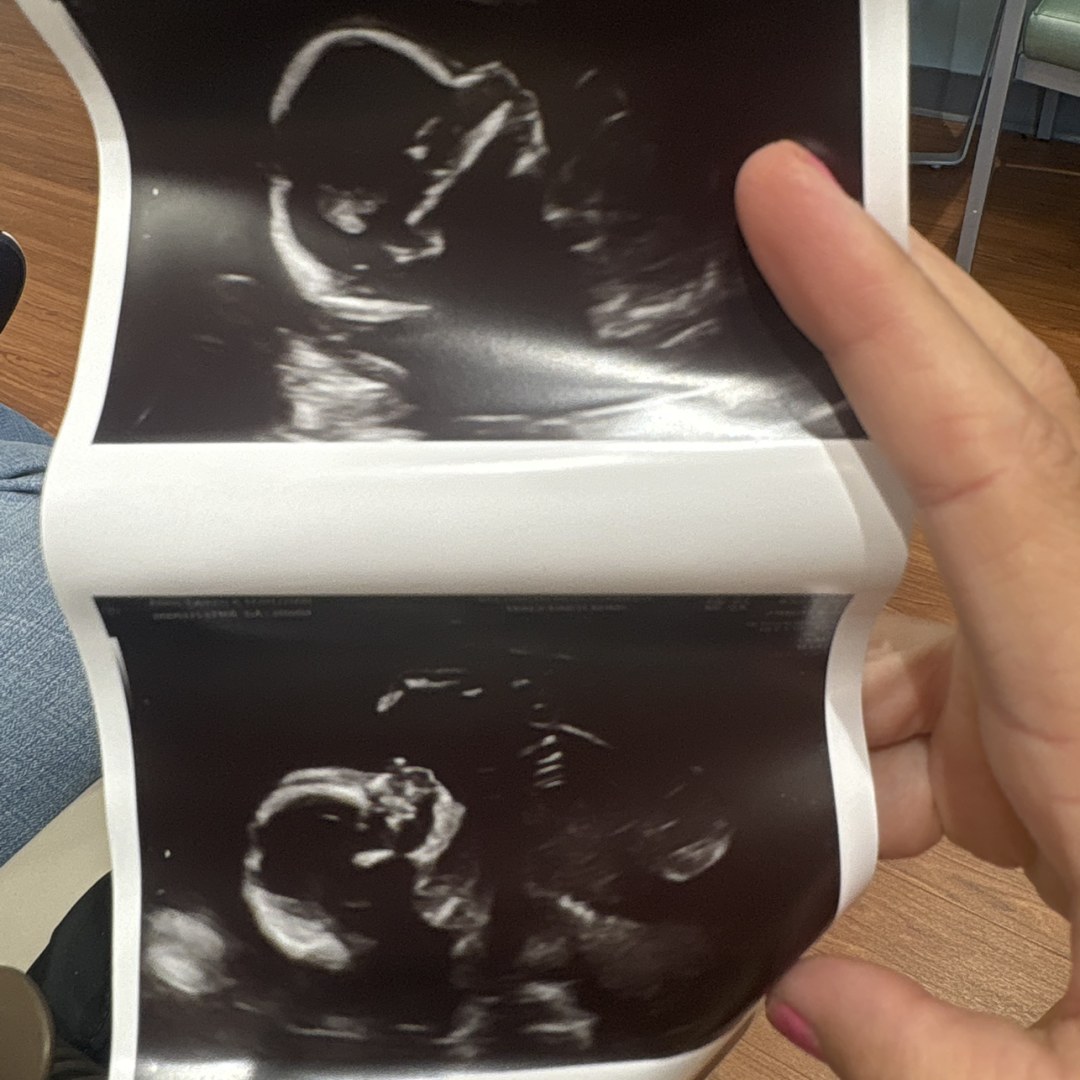 Photo shared by Lauren for their Babylist baby registry.