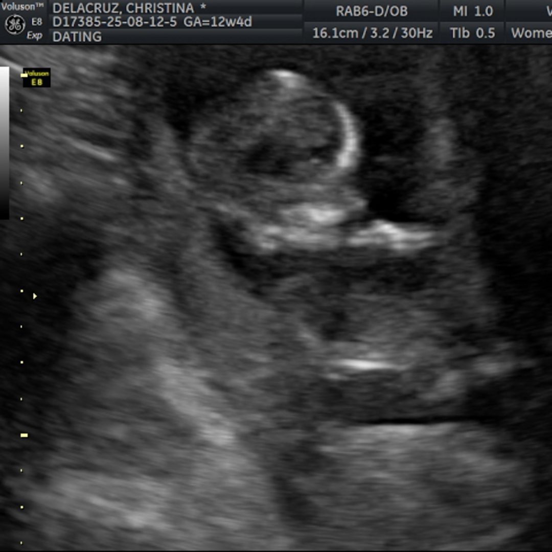 Photo shared by Christina for their Babylist baby registry.
