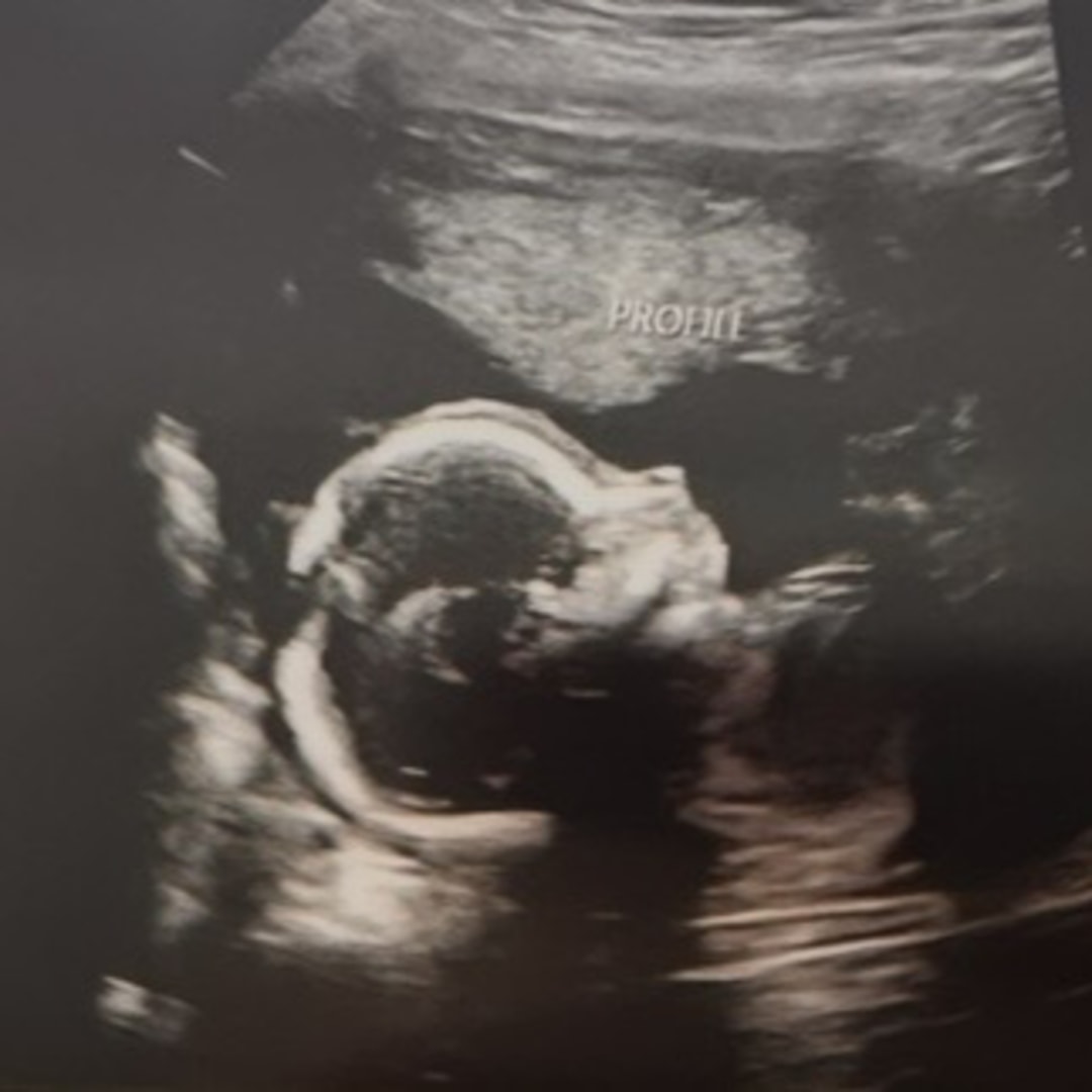 Photo shared by Kayleigh for their Babylist baby registry.