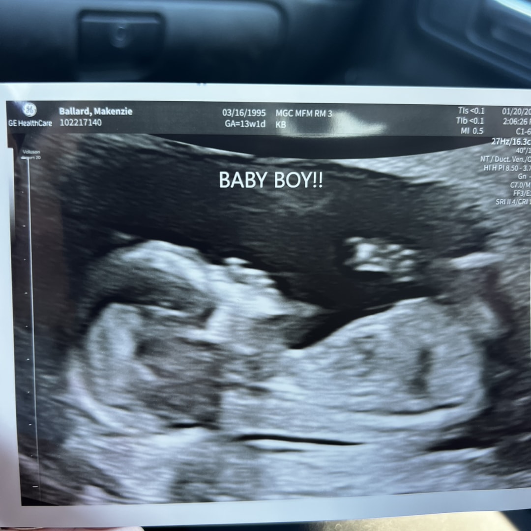 Photo shared by Makenzie for their Babylist baby registry.