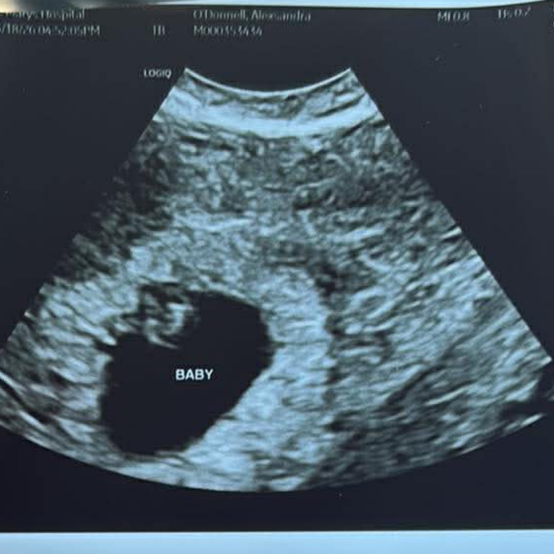 Photo shared by Allie for their Babylist baby registry.