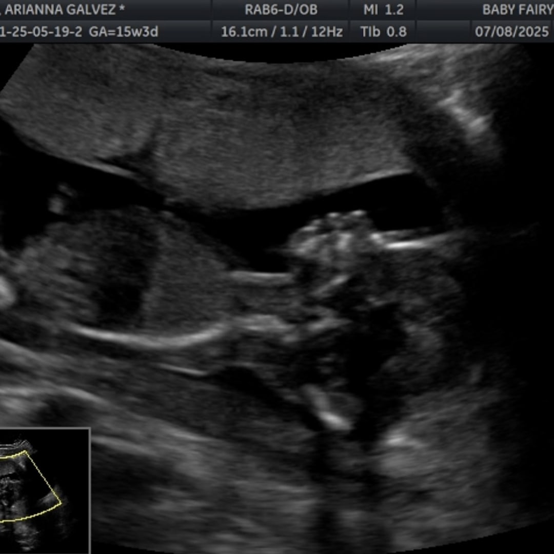 Photo shared by Arianna Galvez & for their Babylist baby registry.