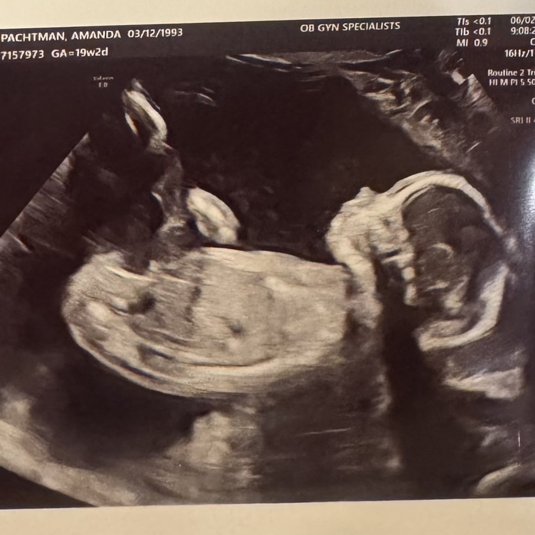 Photo shared by Amanda for their Babylist baby registry.