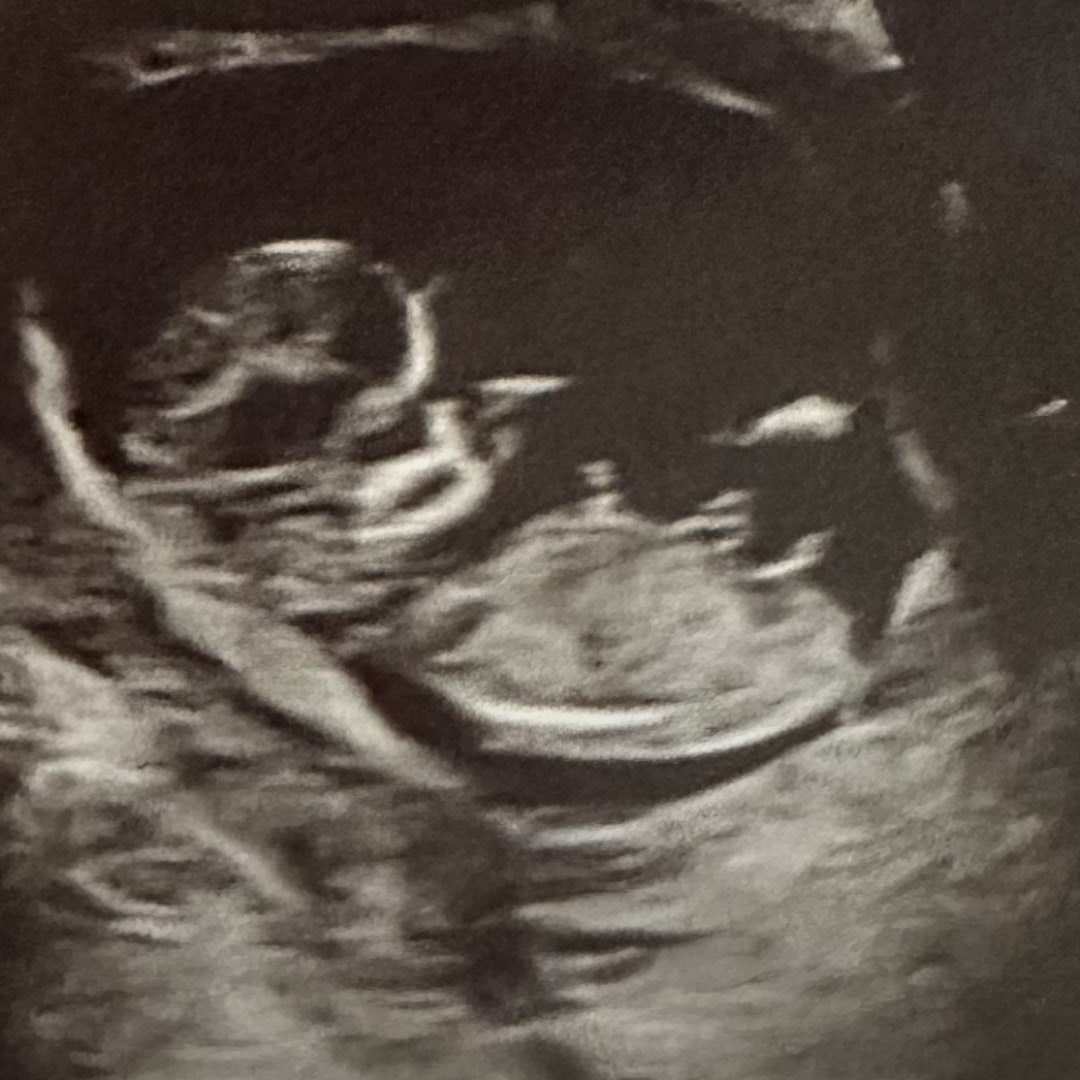 Photo shared by Hayley for their Babylist baby registry.