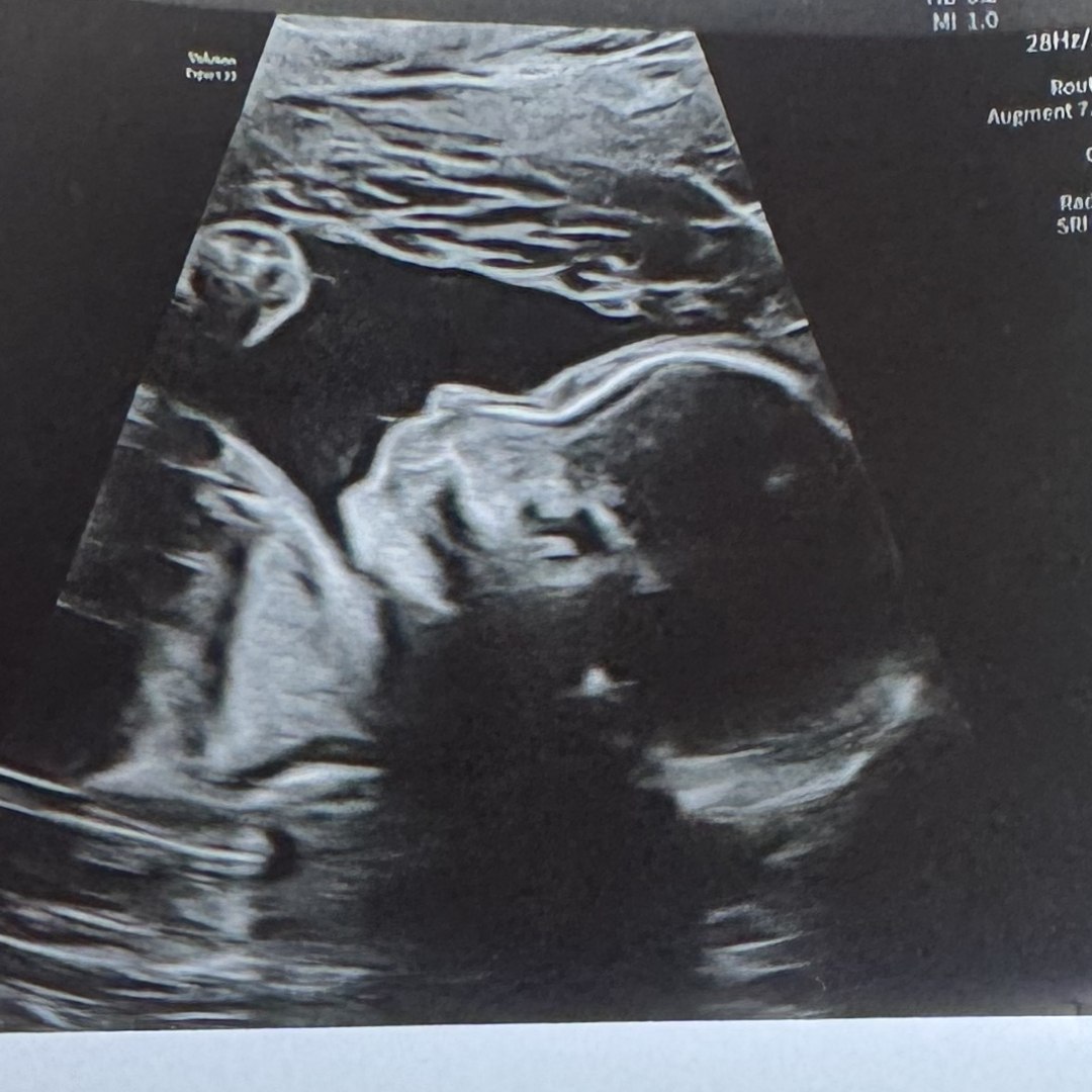 Photo shared by Kendra for their Babylist baby registry.