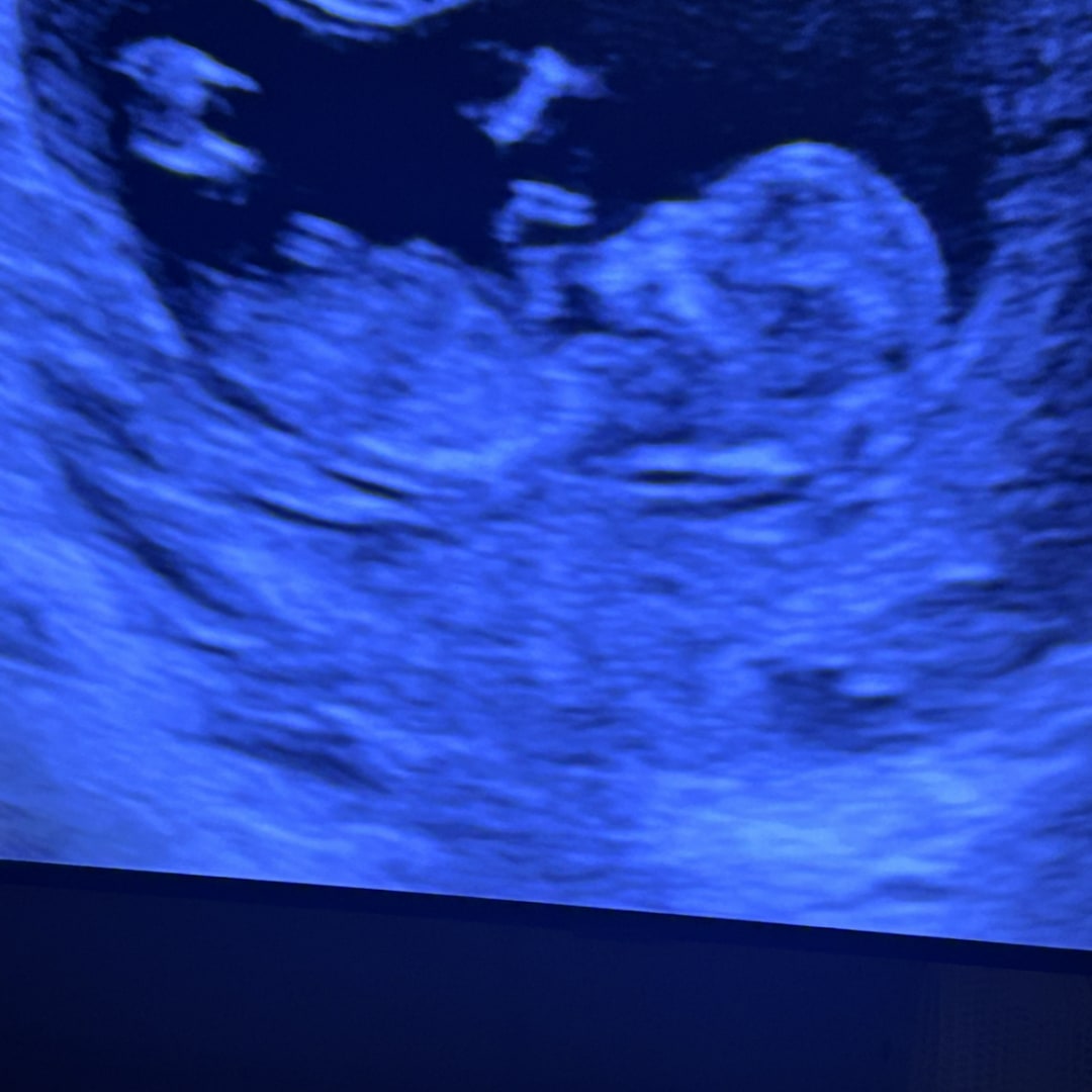 Photo shared by Erica for their Babylist baby registry.