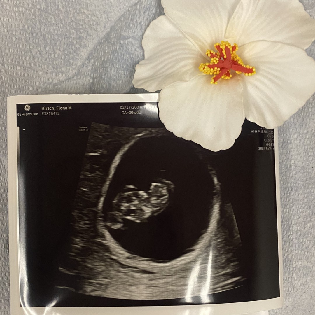 Photo shared by Fiona for their Babylist baby registry.