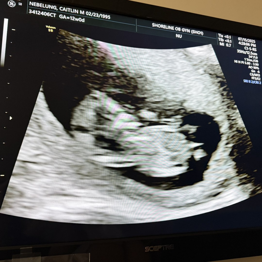 Photo shared by Caitlin for their Babylist baby registry.