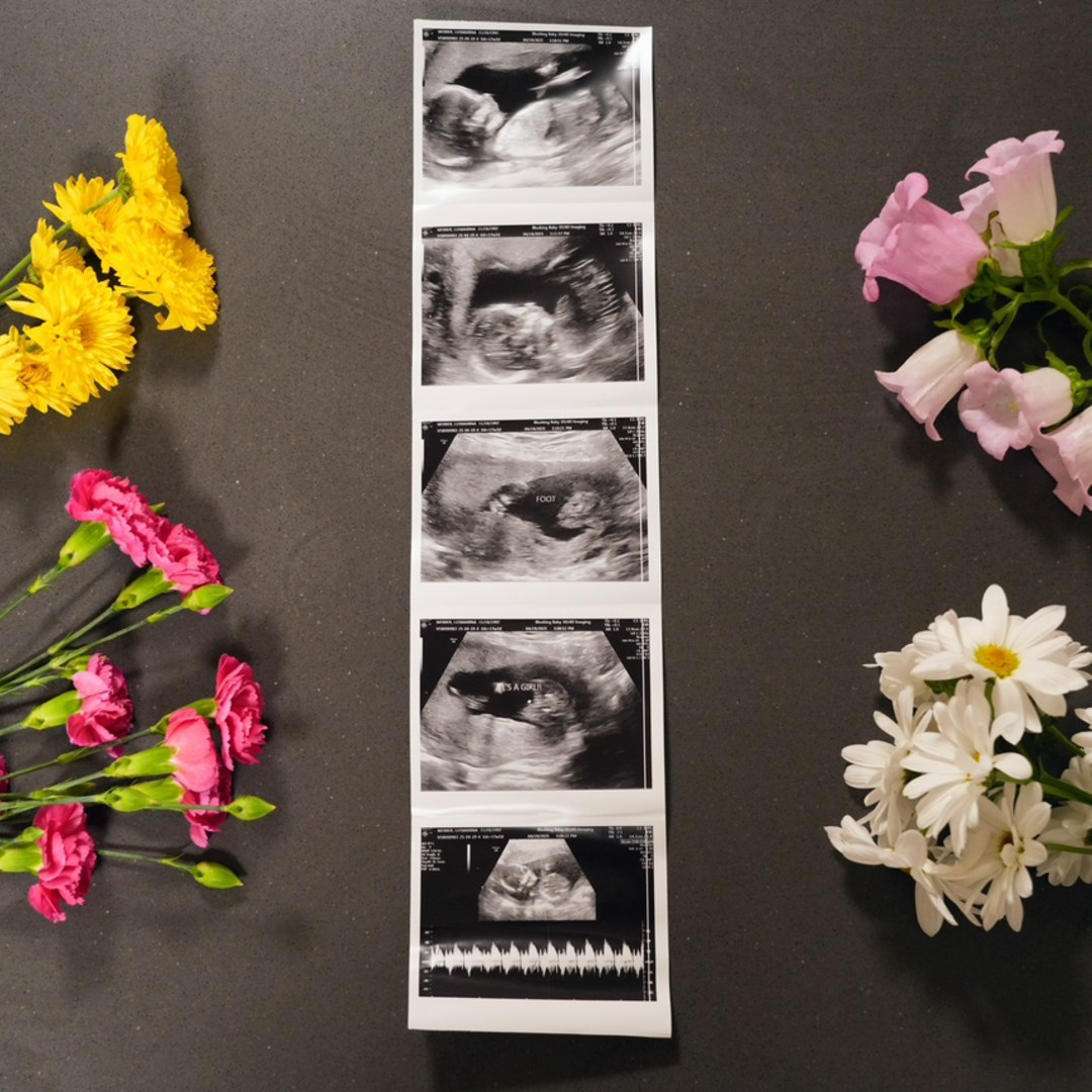 Photo shared by Lucy for their Babylist baby registry.