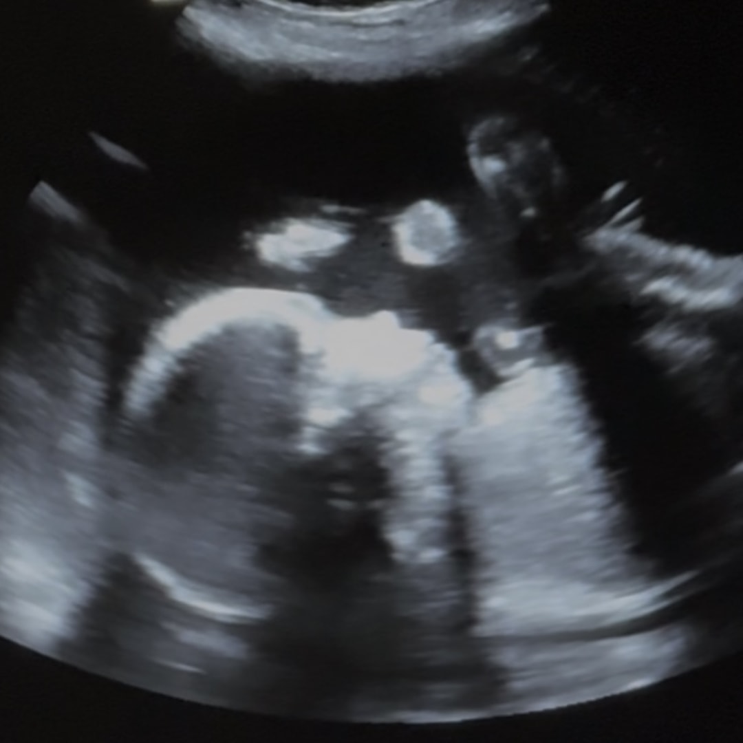 Photo shared by Emelie for their Babylist baby registry.