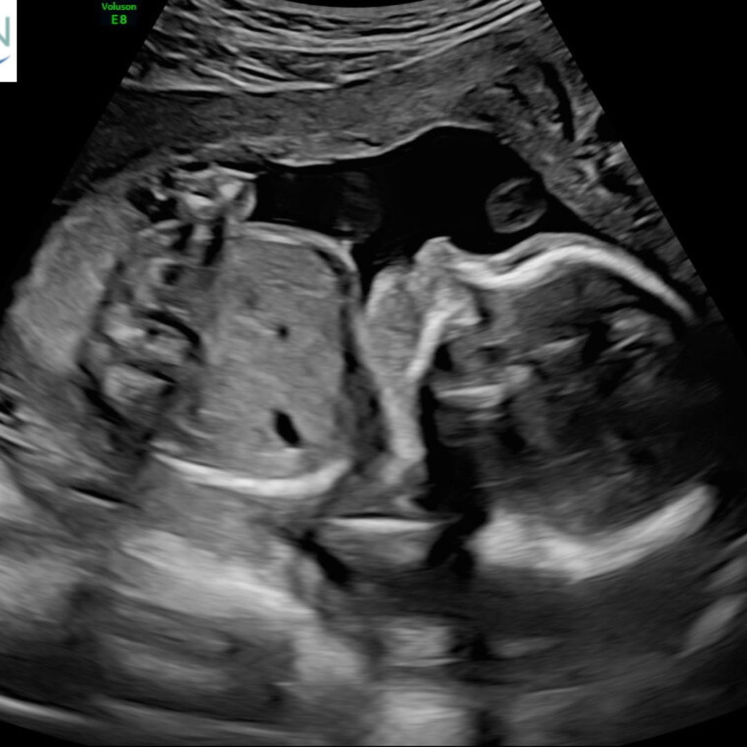 Photo shared by Ellie for their Babylist baby registry.