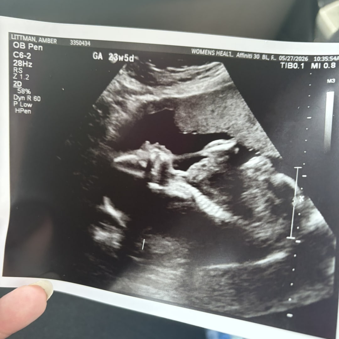 Photo shared by Amber for their Babylist baby registry.