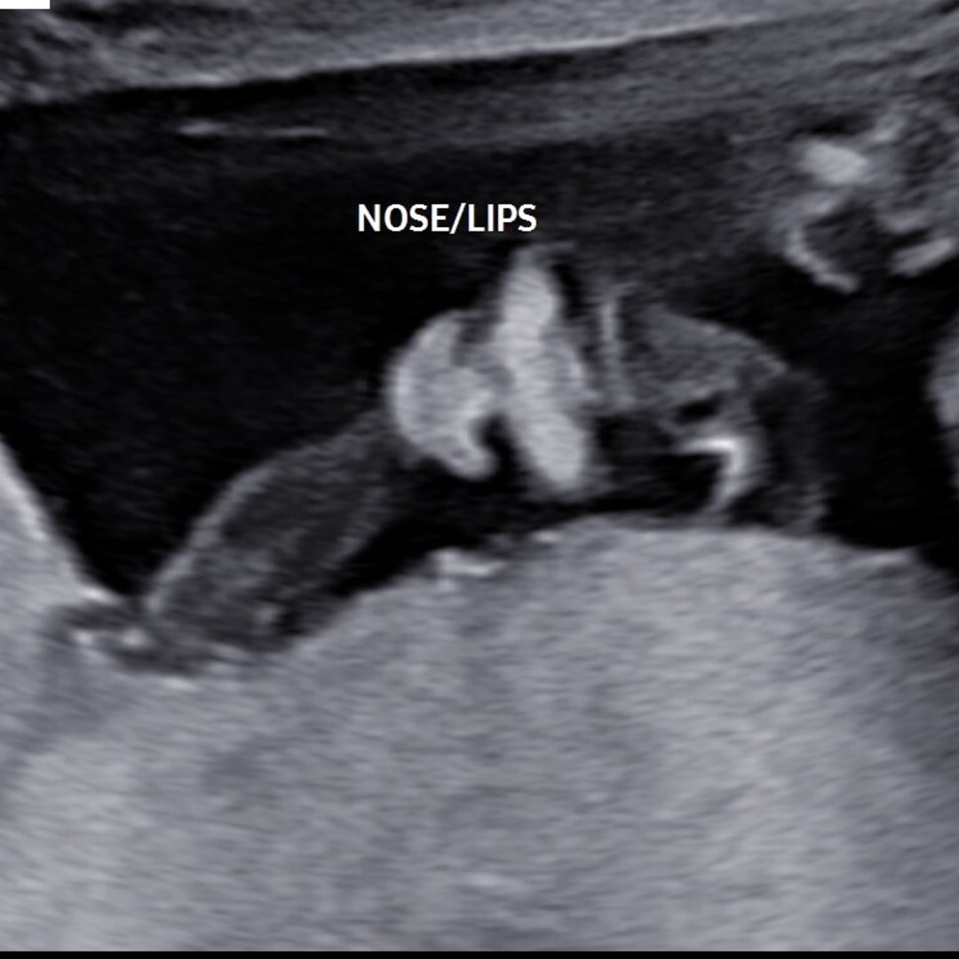 Photo shared by Kirsten for their Babylist baby registry.