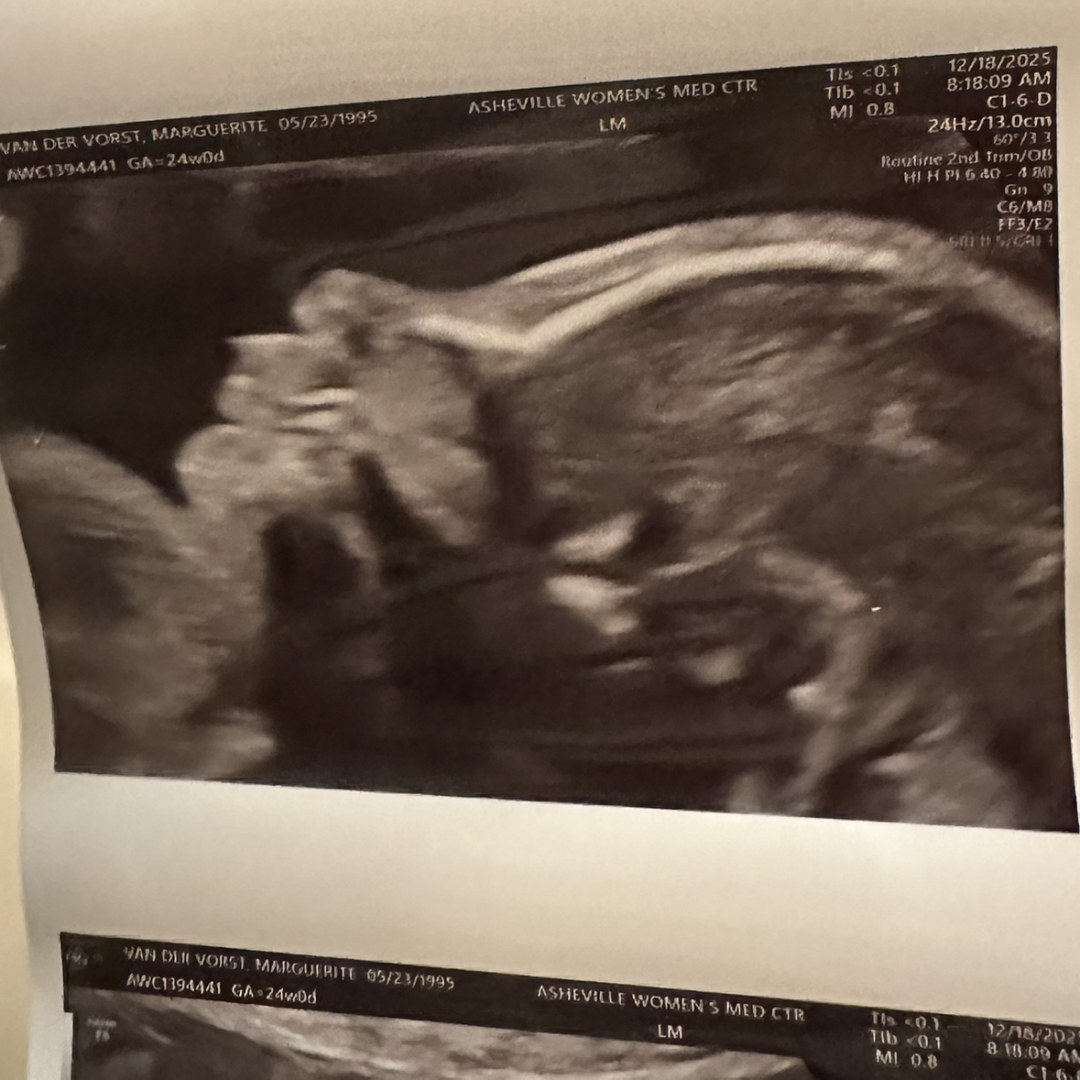 Photo shared by Marguerite for their Babylist baby registry.