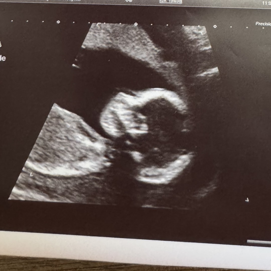 Photo shared by Samantha for their Babylist baby registry.