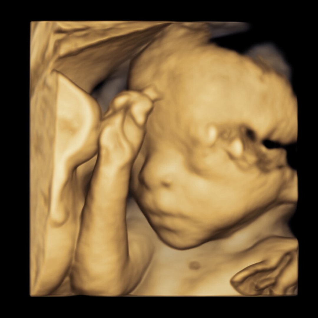 Photo shared by Iyona for their Babylist baby registry.