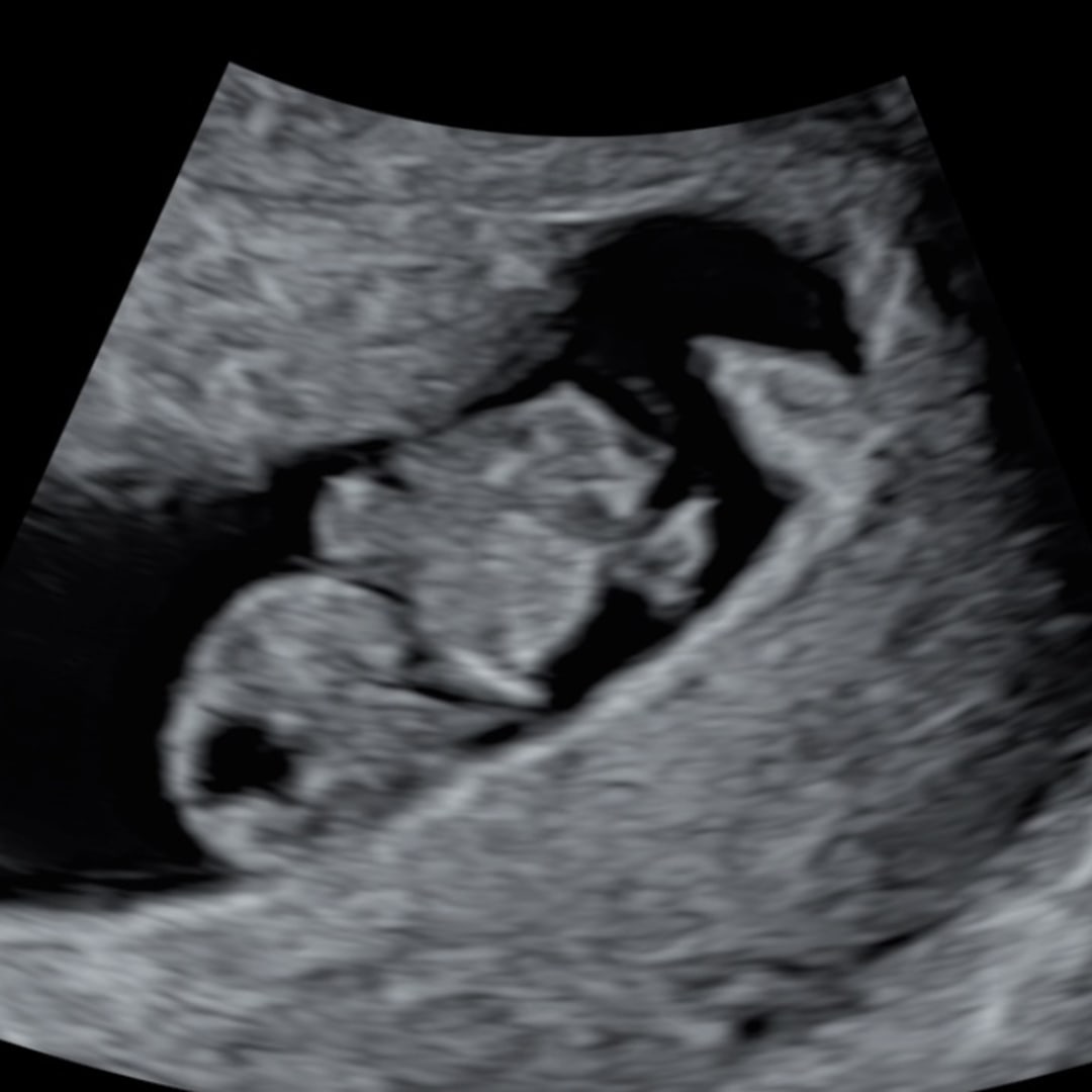 Photo shared by Claire and Nathaniel for their Babylist baby registry.