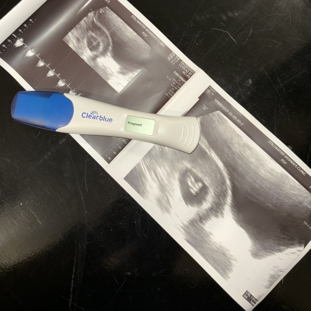 Photo shared by Amber for their Babylist baby registry.
