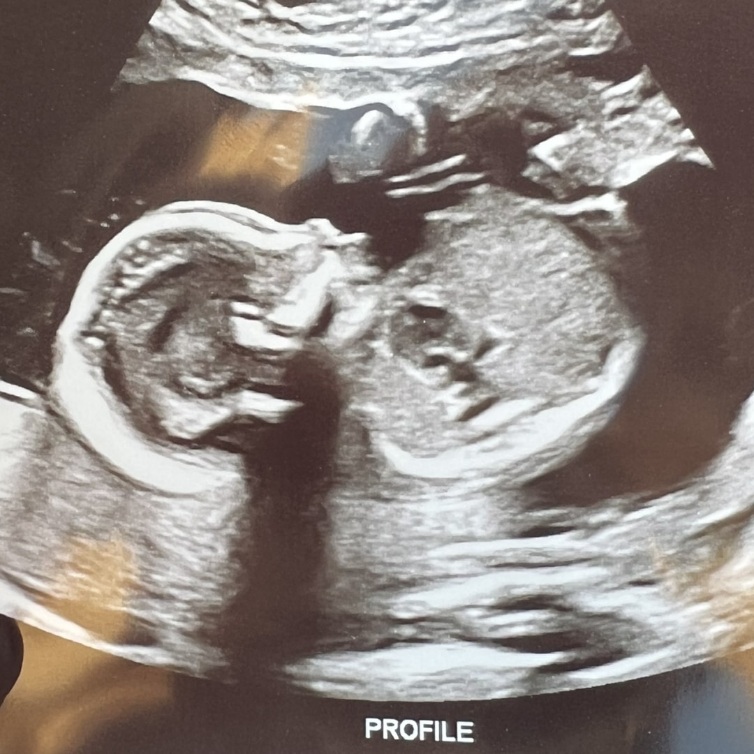 Photo shared by Teia for their Babylist baby registry.