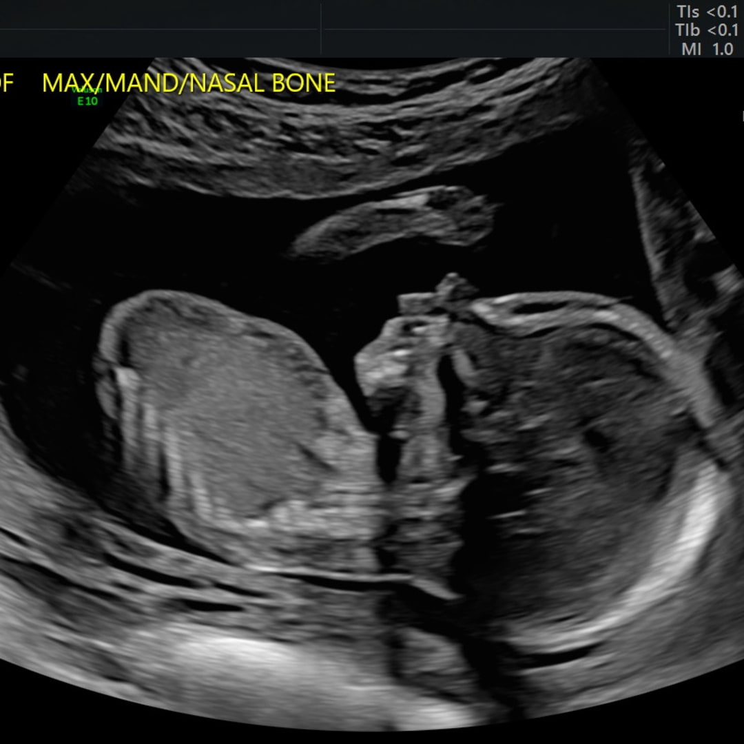 Photo shared by Olivia for their Babylist baby registry.