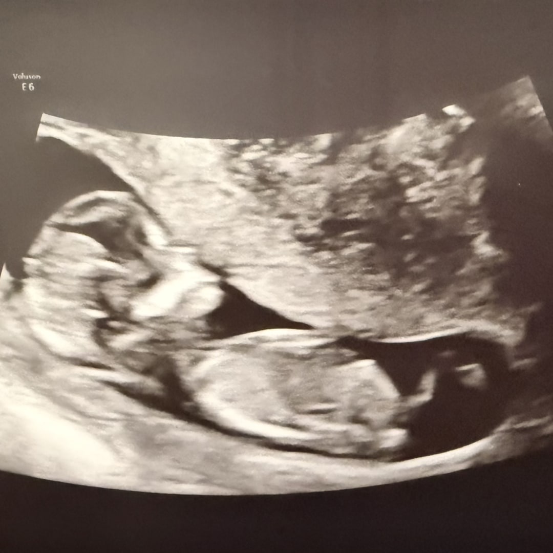 Photo shared by Sharelle for their Babylist baby registry.