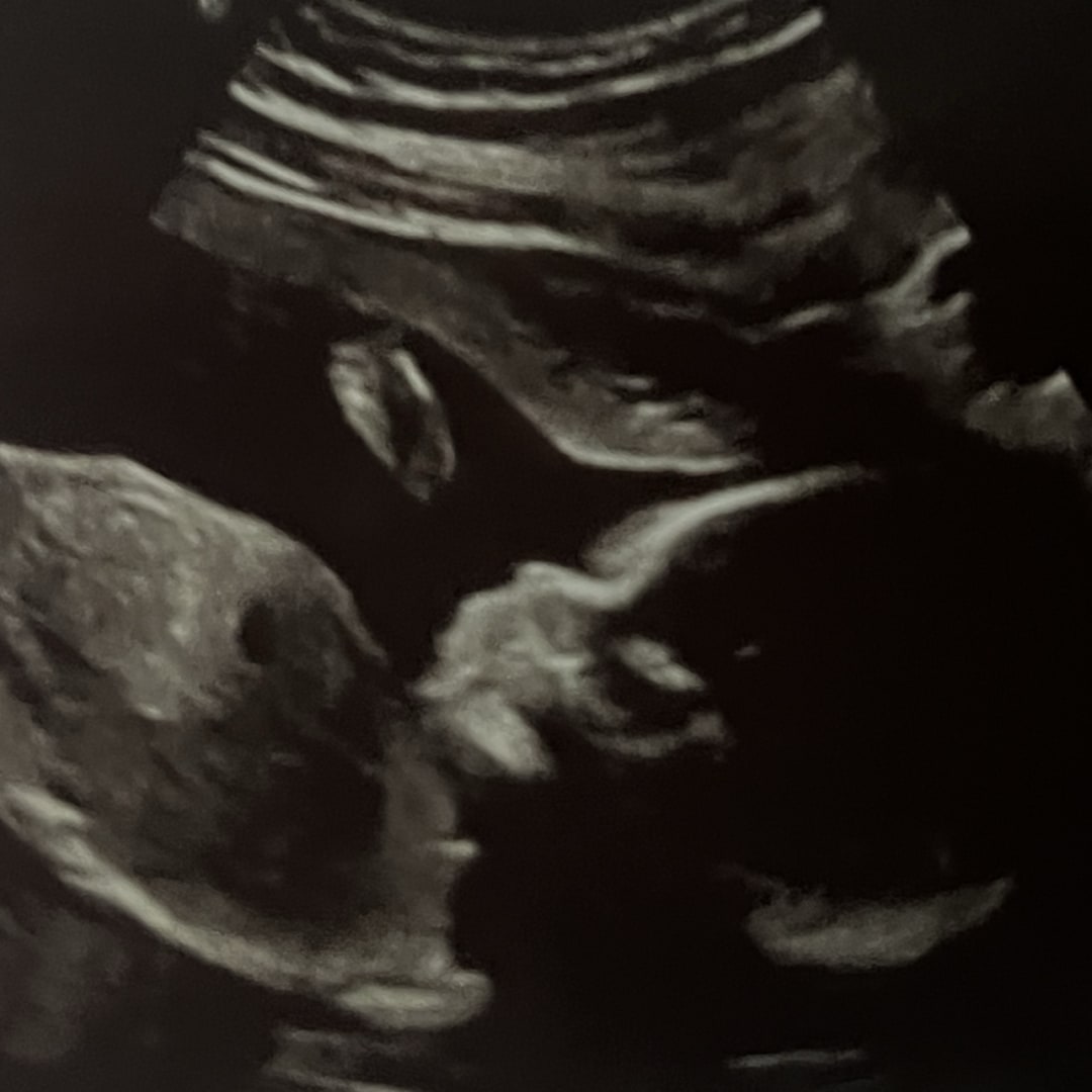 Photo shared by Aleighsha for their Babylist baby registry.