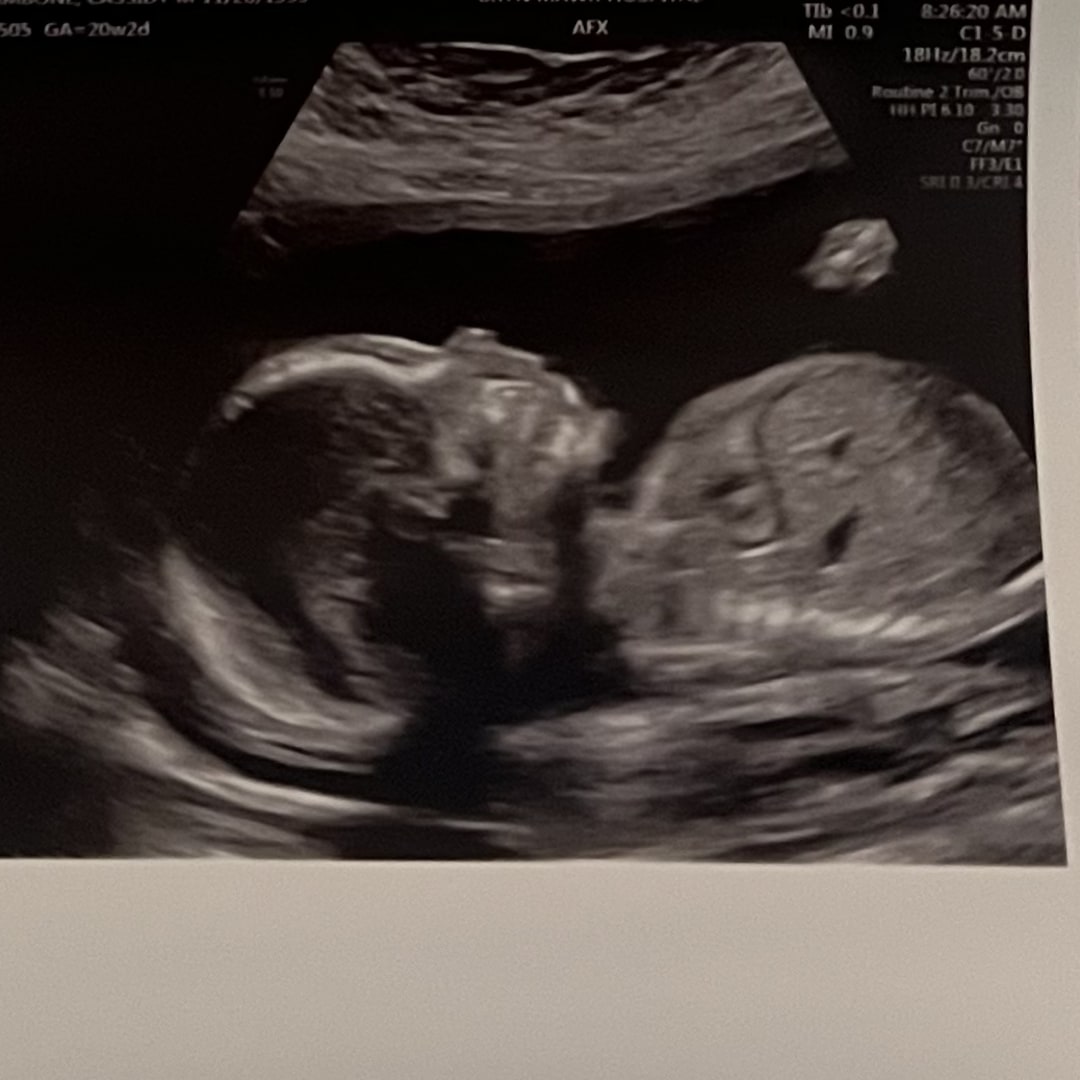 Photo shared by Cassidy for their Babylist baby registry.