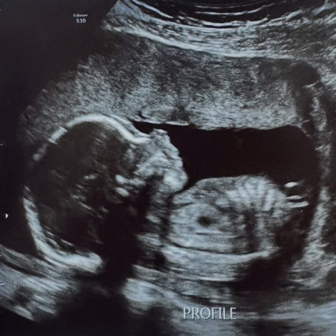 Photo shared by Morgan for their Babylist baby registry.