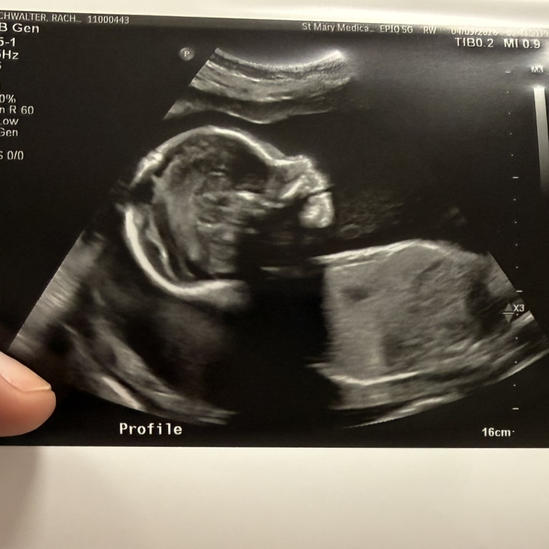 Photo shared by Rachel for their Babylist baby registry.