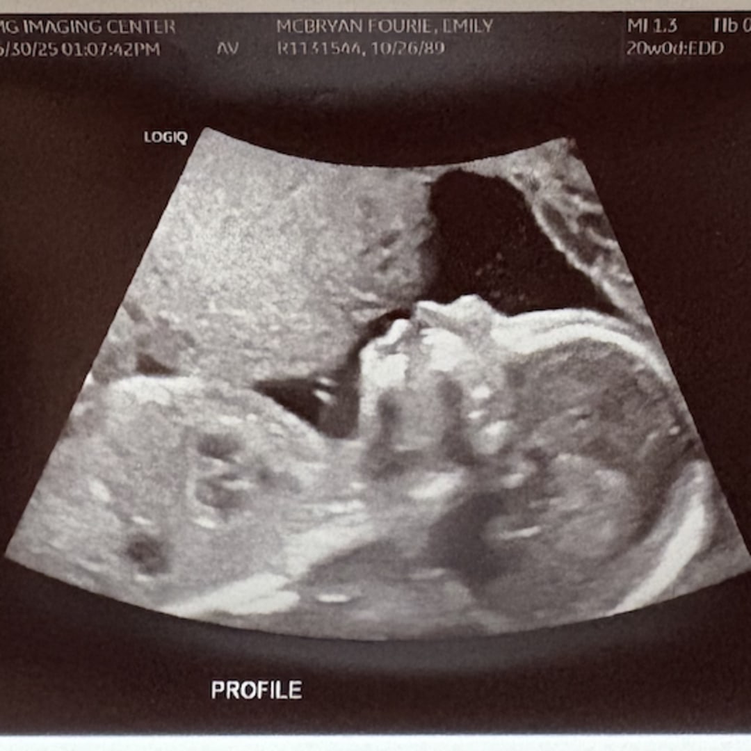 Photo shared by Emily for their Babylist baby registry.