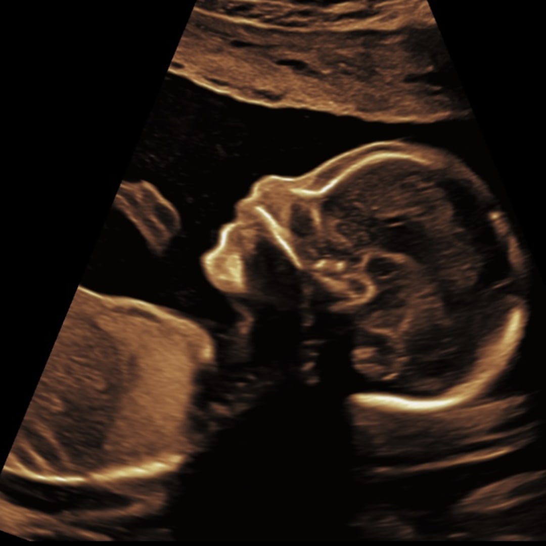 Photo shared by Danielle for their Babylist baby registry.