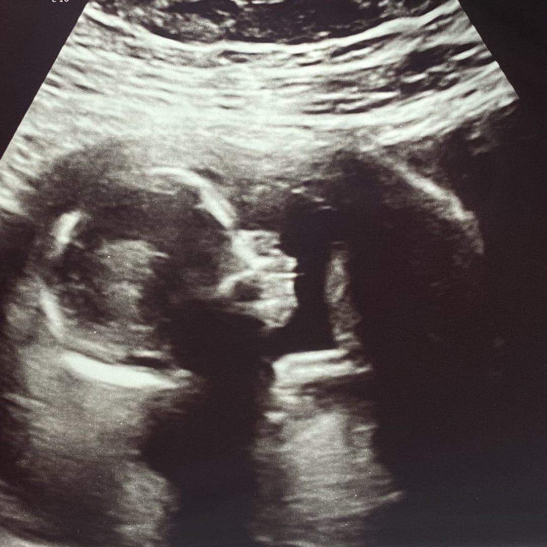 Photo shared by Amanda for their Babylist baby registry.