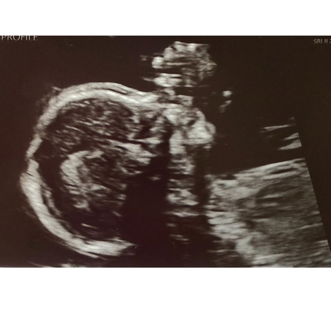 Photo shared by Megan for their Babylist baby registry.