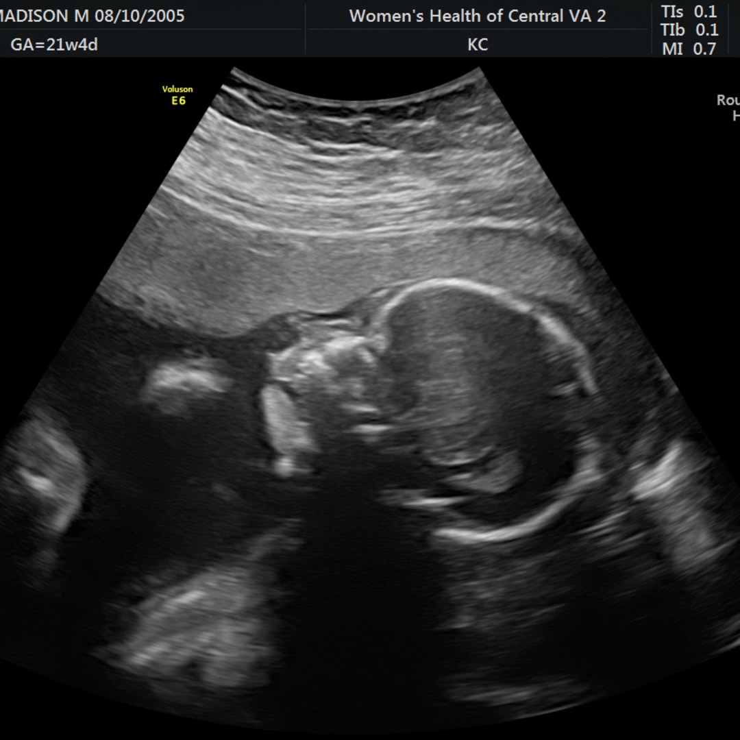 Photo shared by Maddie for their Babylist baby registry.