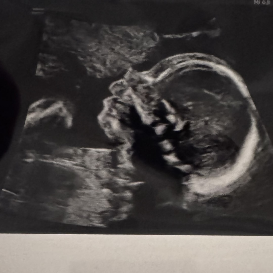 Photo shared by Natalie for their Babylist baby registry.