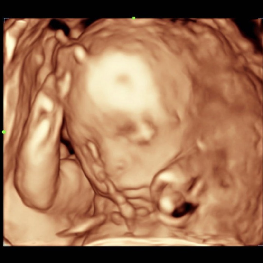Photo shared by Delana for their Babylist baby registry.