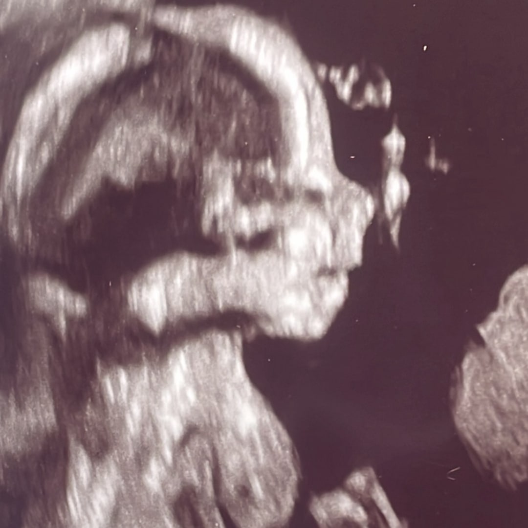 Photo shared by Olivia for their Babylist baby registry.